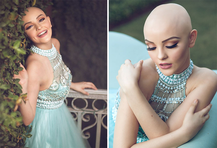 фотосессия лысого подростка с раком andrea sierra salazar gerardo garmendia 41